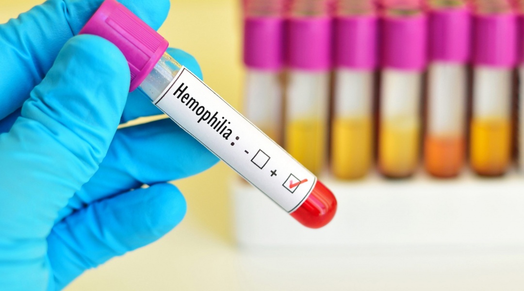 Što je hemofilija?
